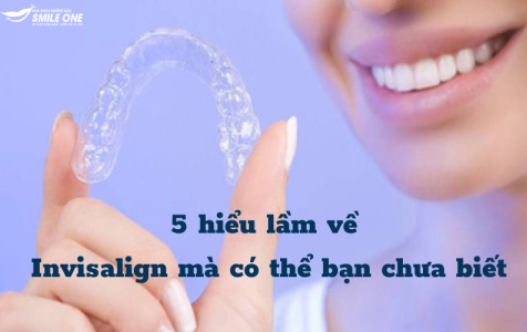 5 hiểu lầm về Invisalign mà có thể bạn chưa biết